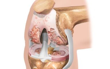 Knee joints