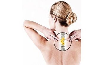 Female cervical osteochondrosis