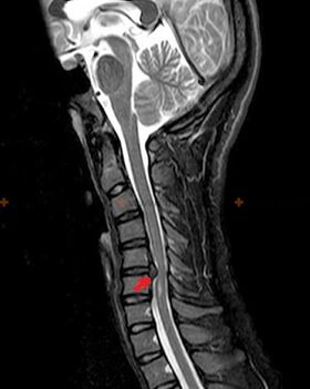 Spine X-ray