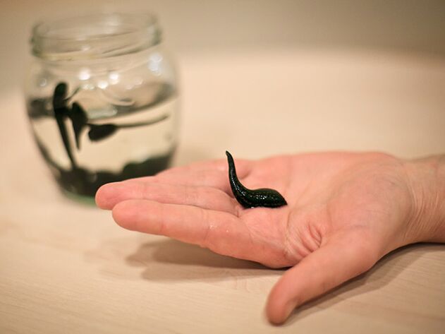 Application in the treatment of knee arthritis