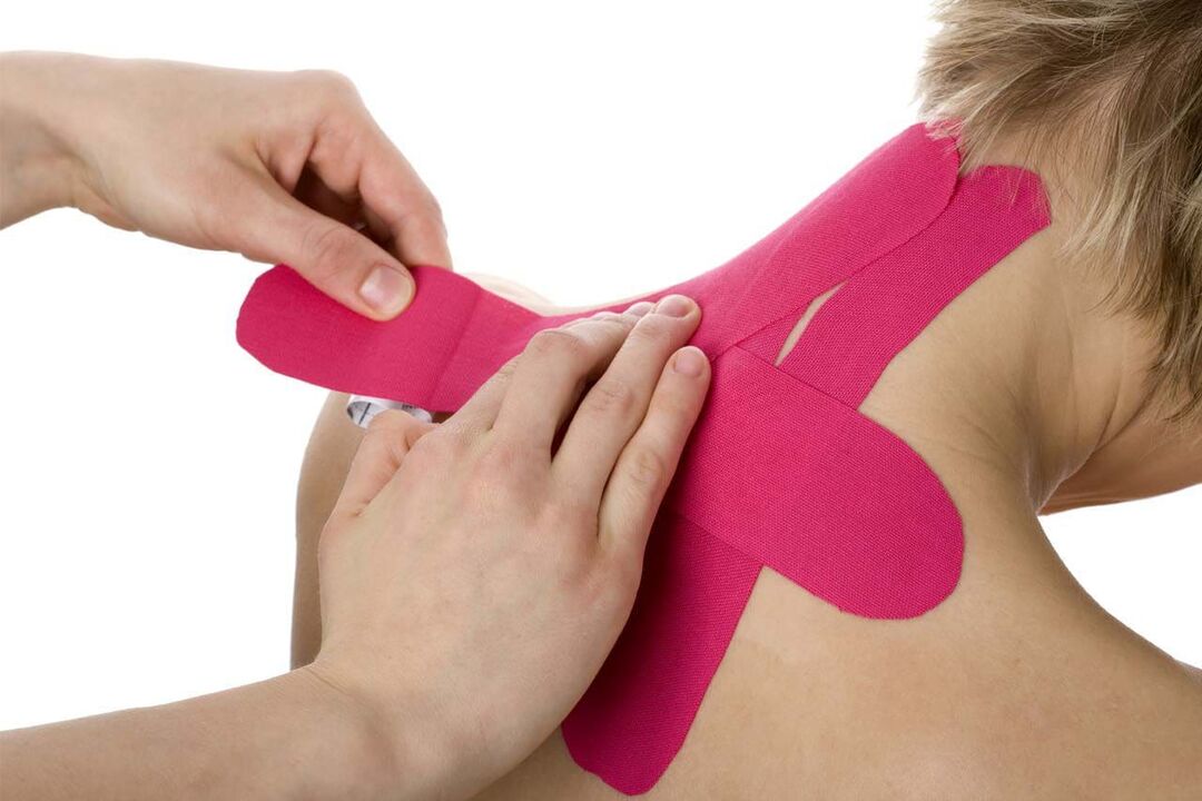 Neck taping to treat osteochondrosis