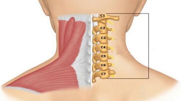 Manifestations of radiculopathy depend on the vertebrae compressing the nerve endings